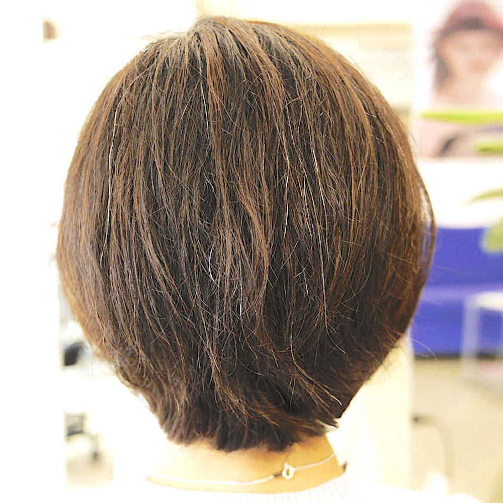 After-kusege-cut-1 year later